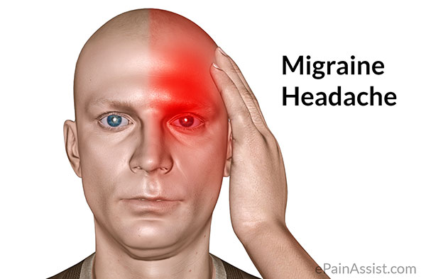 Migraine Headaches
